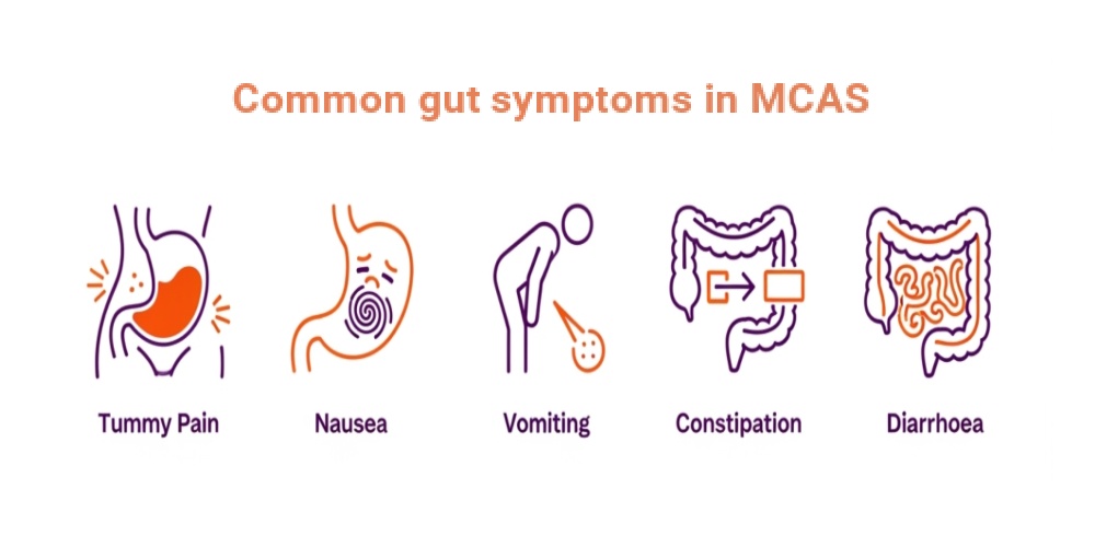Common gut symptoms in mast cell activation syndrome courierpharmacy.co.uk